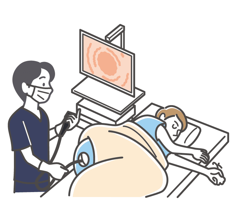 大腸カメラ